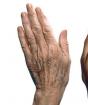 Парафинотерапия для рук в домашних условиях: отзывы Что нужно для парафинотерапии рук в салоне